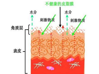 角质层薄怎么修复增厚，改善增厚角质层的办法