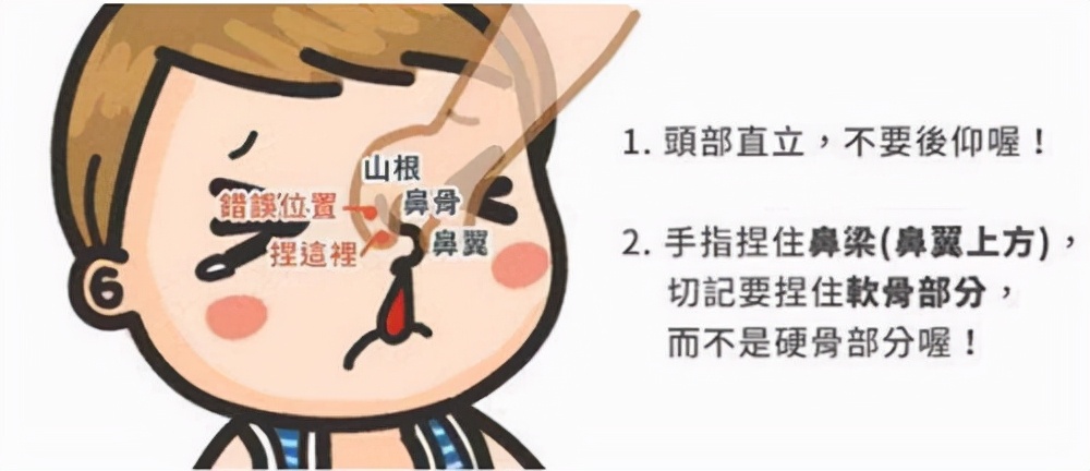反复流鼻血怎么办？会不会是白血病？