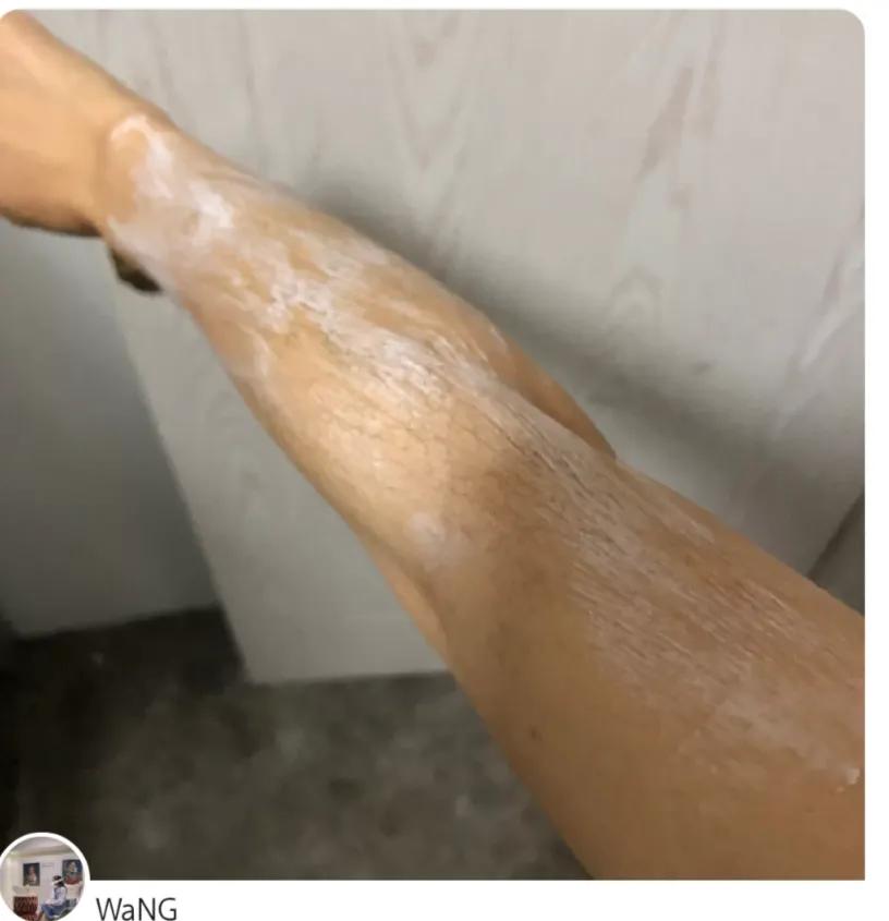 每個人的身上都有毛毛，我們一起脫毛毛