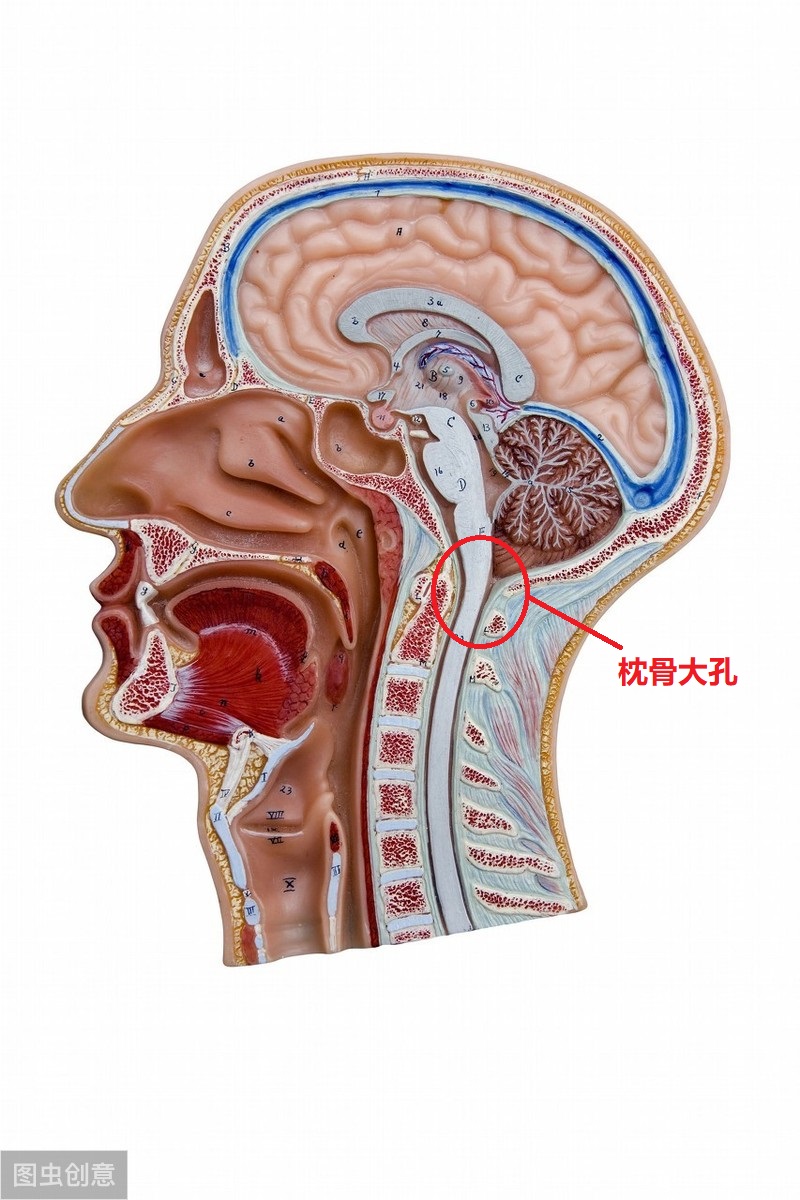 脑梗塞“开刀”做外科手术就能好？听听脑科医生怎么说