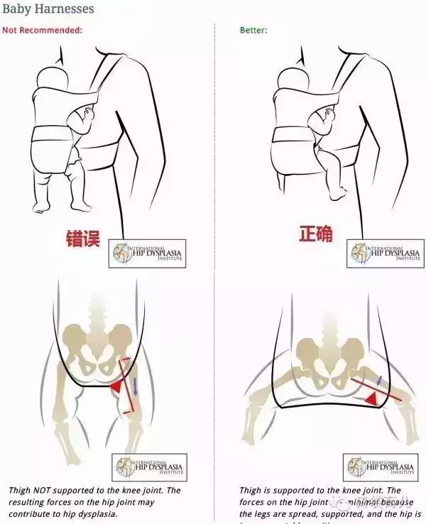 腰凳背带用对了是带娃神器，用错了却是坑娃“凶器”！