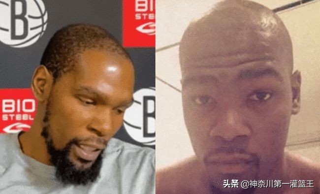 为什么许多nba 球星都秃顶(比普通人都要强壮，为何妖刀、杜兰特和詹姆斯都会早早谢顶？)