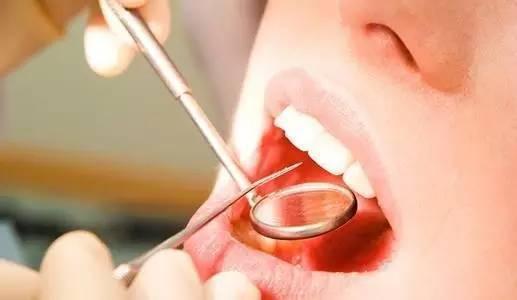 “牙结石”可以自己抠掉吗？教你一招，牙缝里的脏东西或能轻松掉