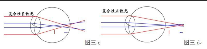 眼镜框架什么材质好，网上眼镜选购指南？