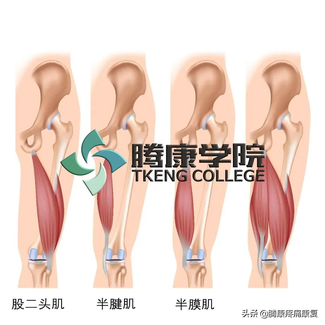 大腿疼痛的原因和治疗原则