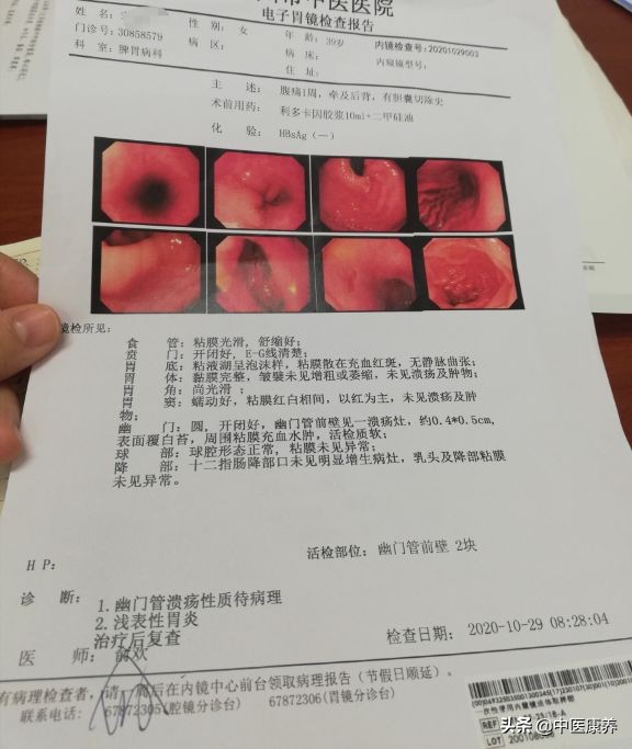 经常打嗝，是身体在向我们求救，几个动作帮你快速解决。