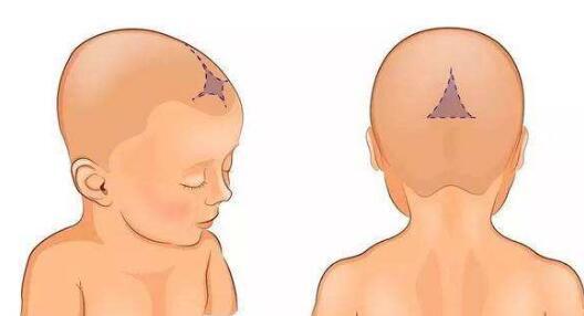 新生儿刚刚出生之后,颅骨还有一个急速增长发育的过程,在颅骨间隙有