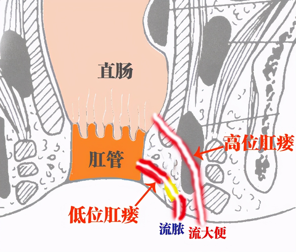 肛门解剖结构图片(菊花残) - 赤虎壹号
