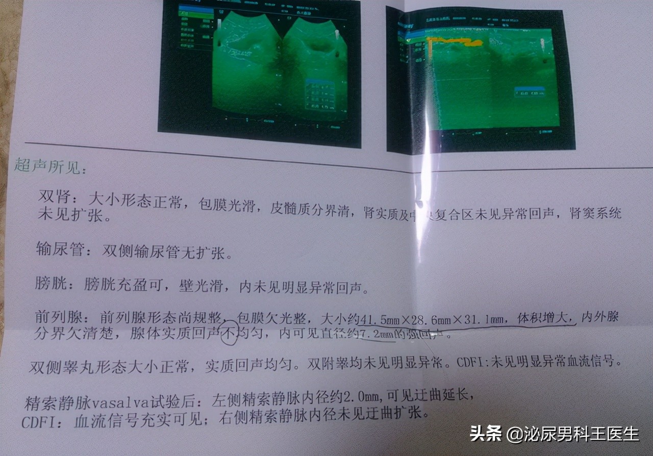 中老年人得了前列腺增生应该怎么办？