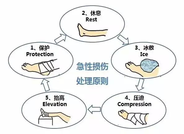 崴脚后只拍X光片就可以吗？医生：这种情况不治疗将会一直崴脚