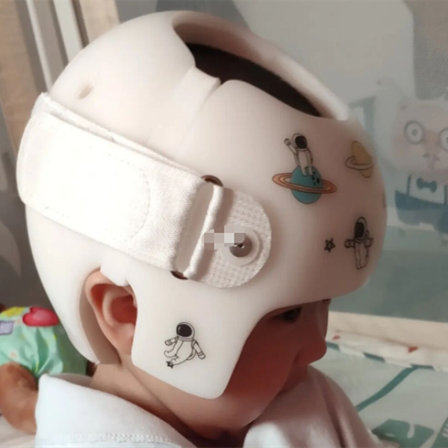 宝宝头型"异常",一定要及时矫正