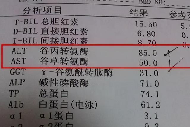 谷丙转氨酶多少是正常(肝功能检查单怎么看) - 青木春
