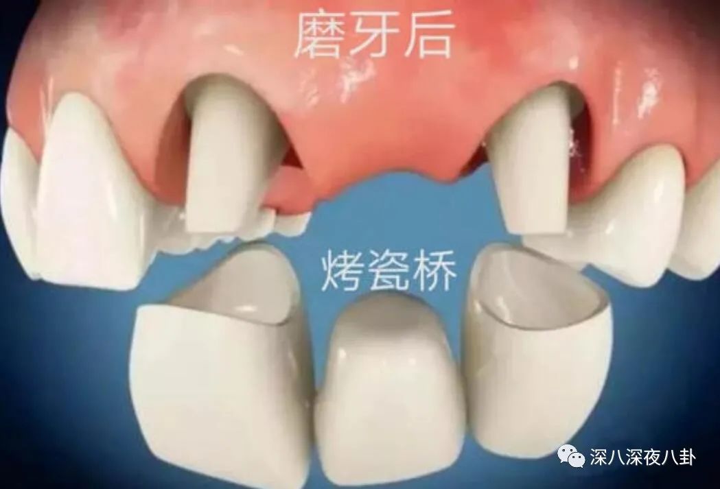 明星再瞎整烤瓷牙就会变成封面上这匹马