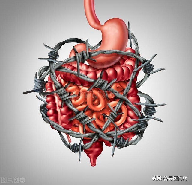 一年做7次胃镜也没查出问题，结果是它在作怪