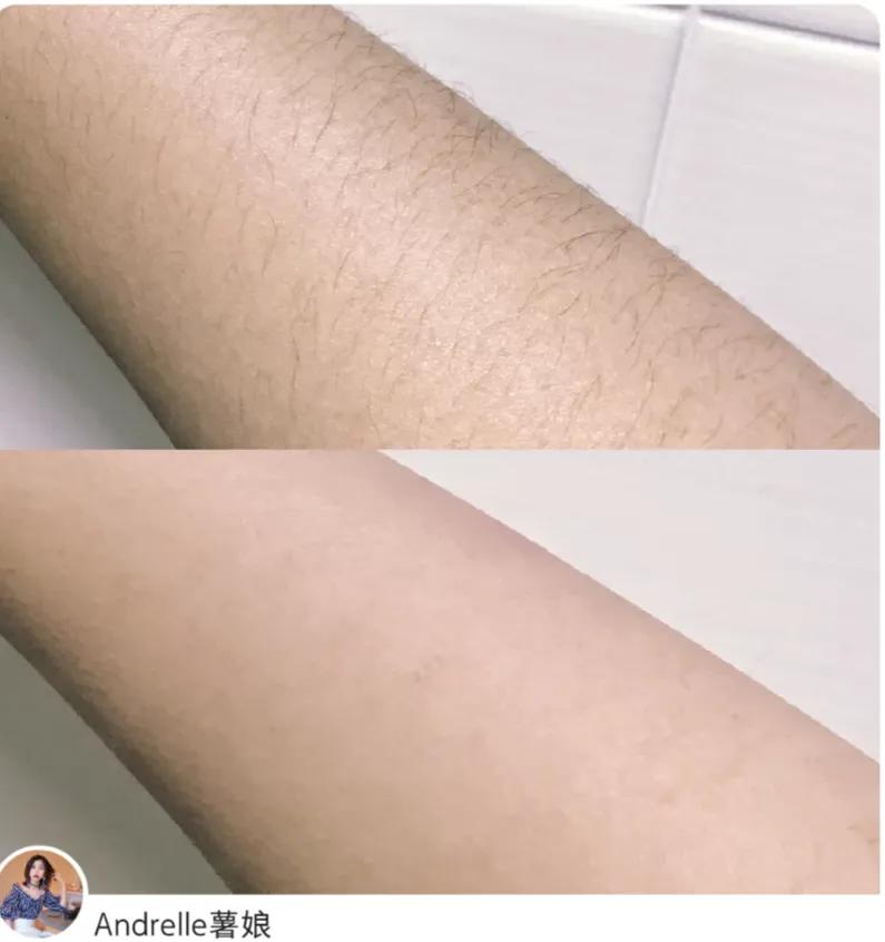 每個人的身上都有毛毛，我們一起脫毛毛