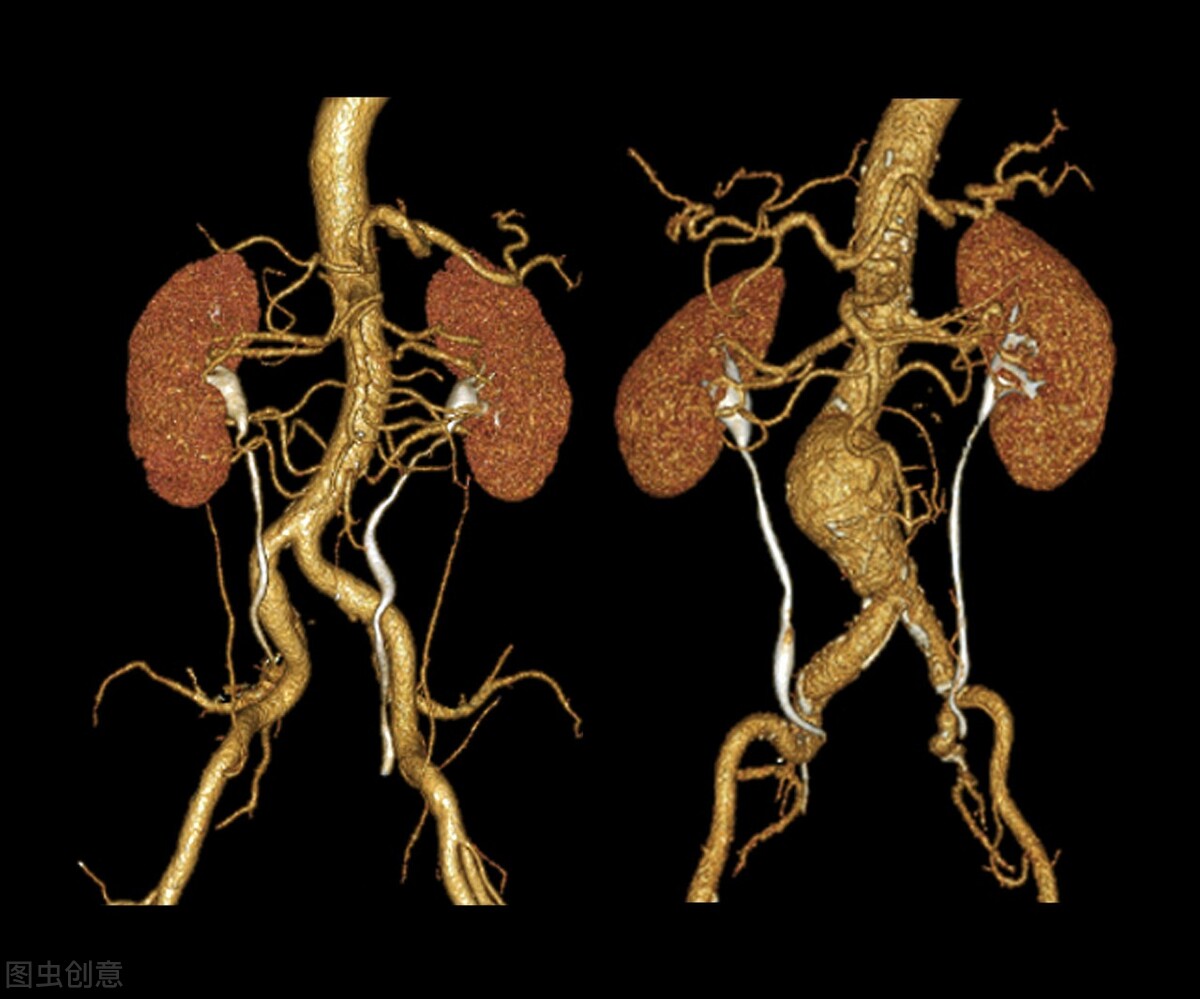 辟谣：肚子疼是小病？有很多腹痛是致命的