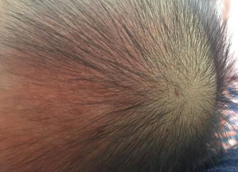 婴儿卤门(囟门真的不能洗吗) - 乐宝宝贝