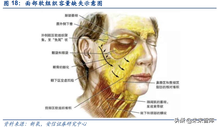 胶原蛋白行业研究：医美赛道添新宠，胶原蛋白迎新风
