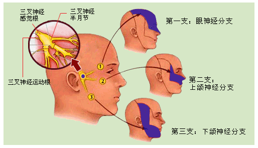 三叉神经疼在哪个部位图片