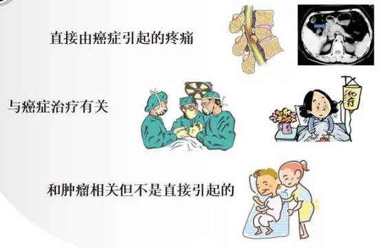 癌痛难忍怎么办？肿瘤晚期疼痛缓解方法