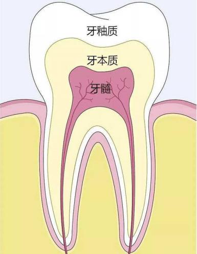 牙齿从内到外,主要由三部分构成:牙釉质,牙本质和牙髓,如图:形成蛀牙