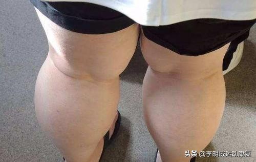 如何有效瘦小腿？