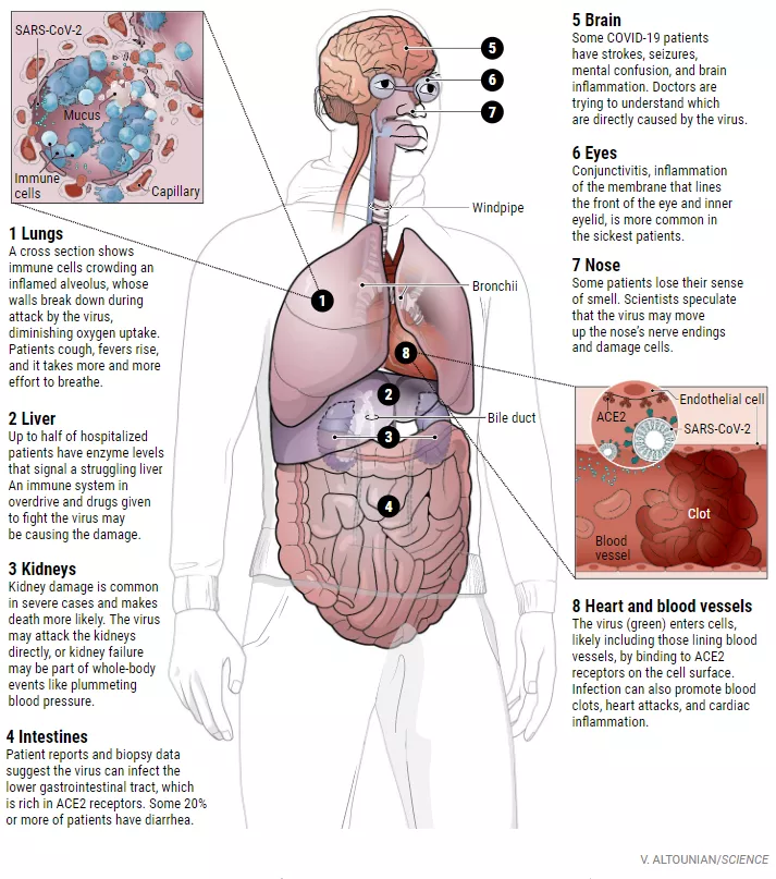 从大脑到脚趾，新冠是如何一步步对器官“下手”的？