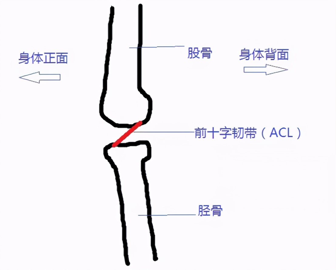 足球比赛中为什么会经常抽筋(5 种常见的足球运动损伤，骨科医生来支招)