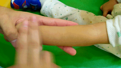 小儿发烧,最常见的这2种类型,该如何推拿?