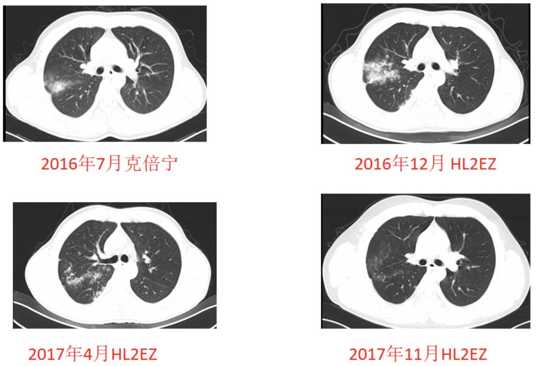 发热腹痛为哪般，抽丝剥茧寻找真相……至今诊断仍存在疑点？