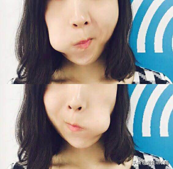 法令纹原来是这么来的！还得这样拯救，赶紧得