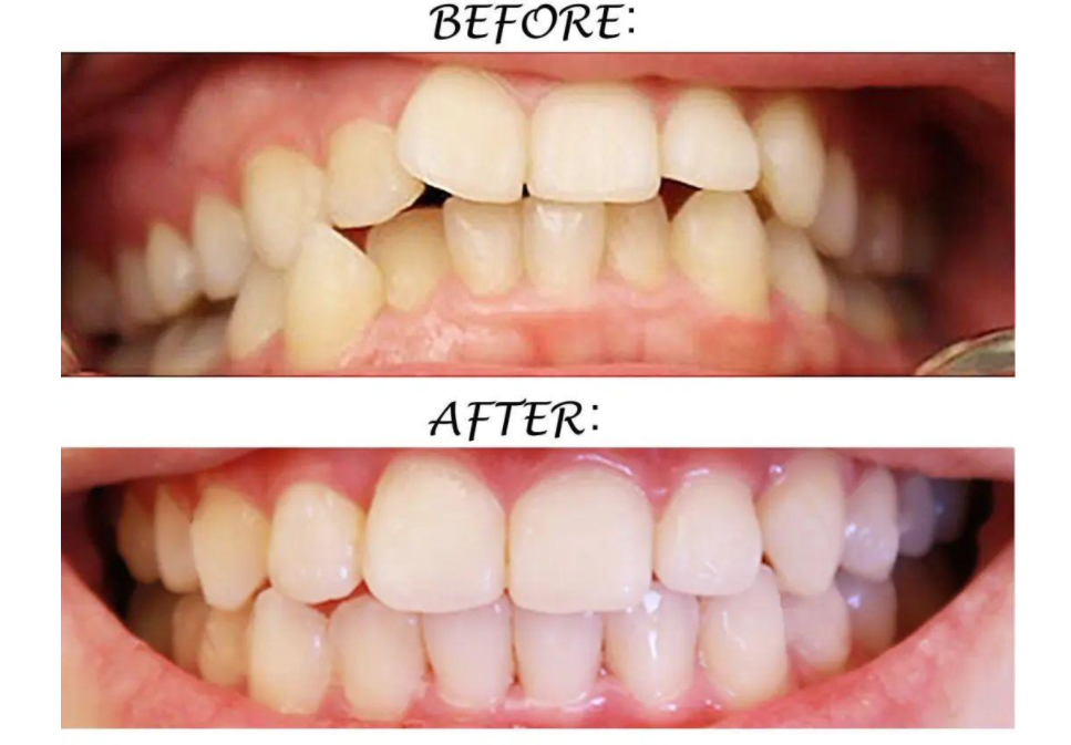 经验分享 | 高考后的假期安排，等你考完来安排吧