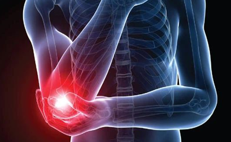 胳膊疼痛咋回事？