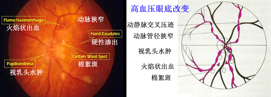 高血压患者要做哪些检查项目？医生教你怎么选，精准有效又省钱