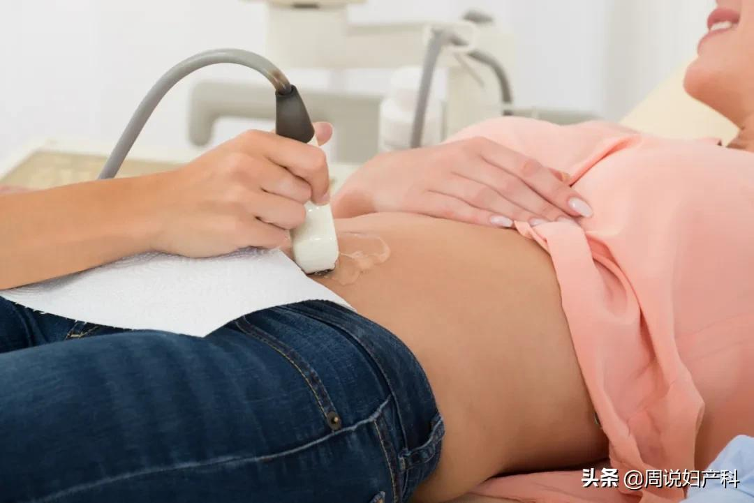 想知道自己的子宫是否健康,一定要每年做这项妇科检查