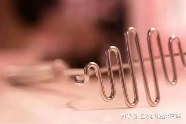 愤怒源于某种需求没有得到满足—《非暴力沟通》