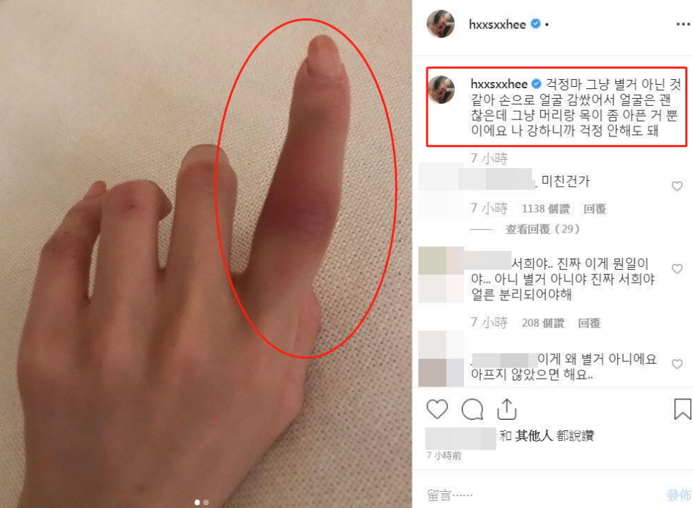韩国女星被家暴，呼救说对方要掐死自己！网友却称两人都不是善茬