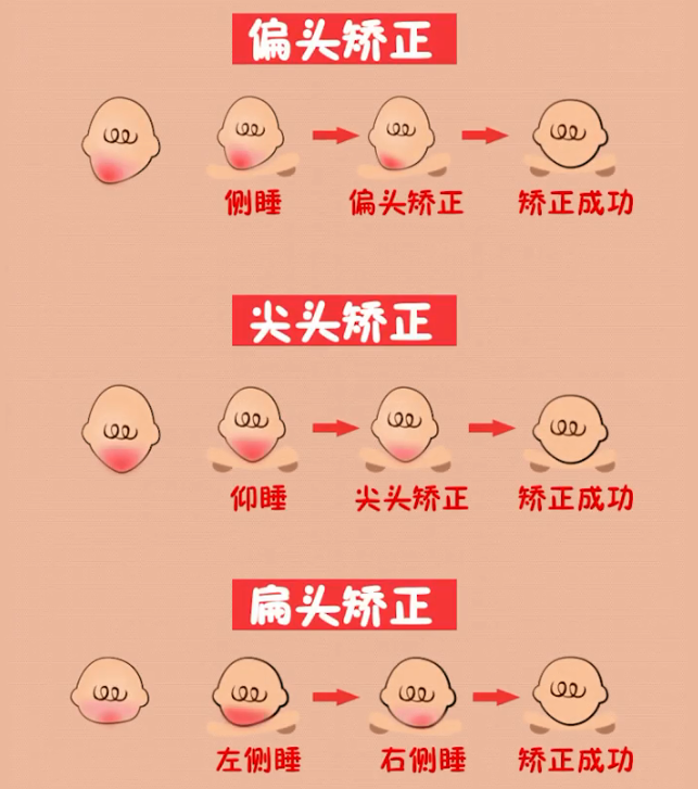 抓住0-1岁宝宝头部定型黄金期，改善宝宝偏头症，使大脑健康发育