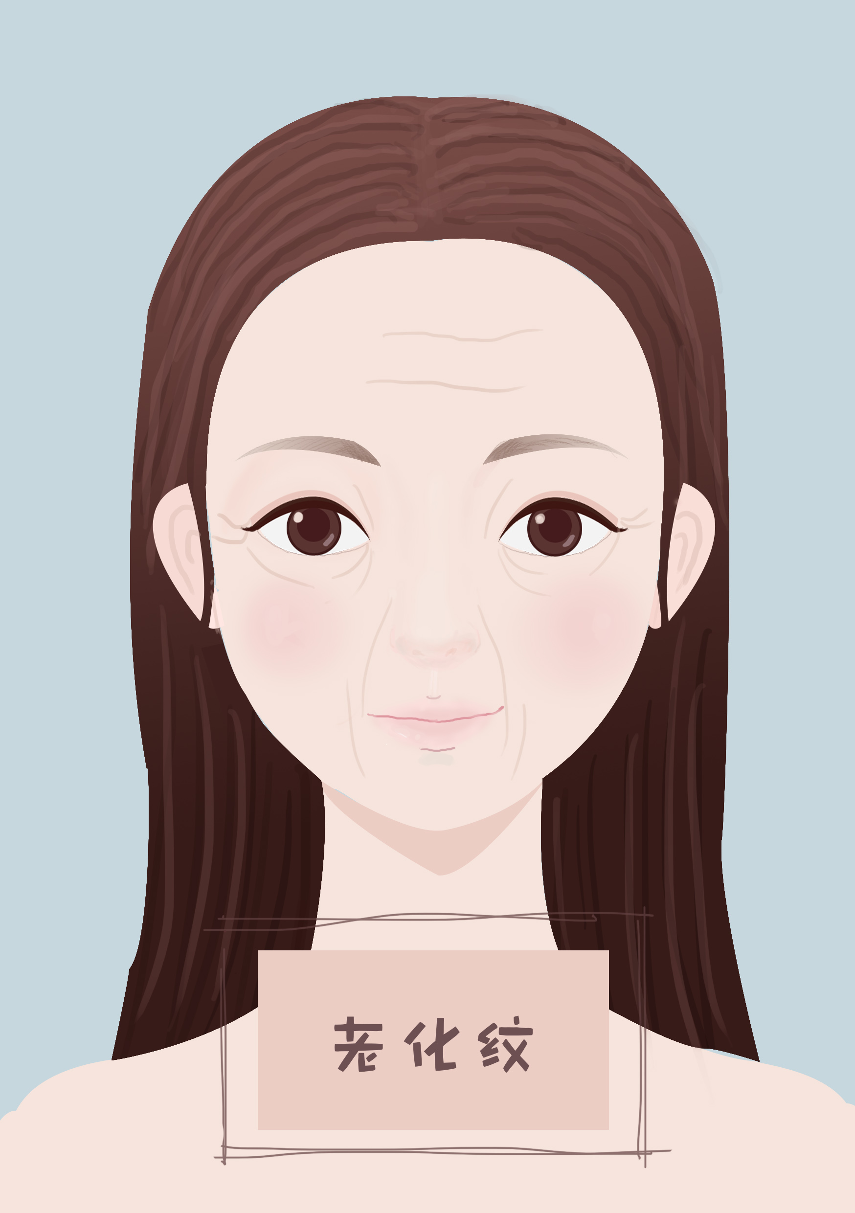 教你四招轻松摆脱法令纹