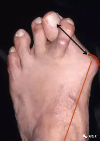 婴儿勾脚趾头(足疗能有什么坏心思) - 乐宝宝贝