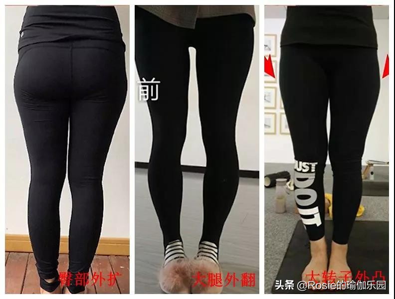 假胯宽、臀肥腿壮？要瘦腿先分清粗腿成因，不走弯路美腿这样瘦