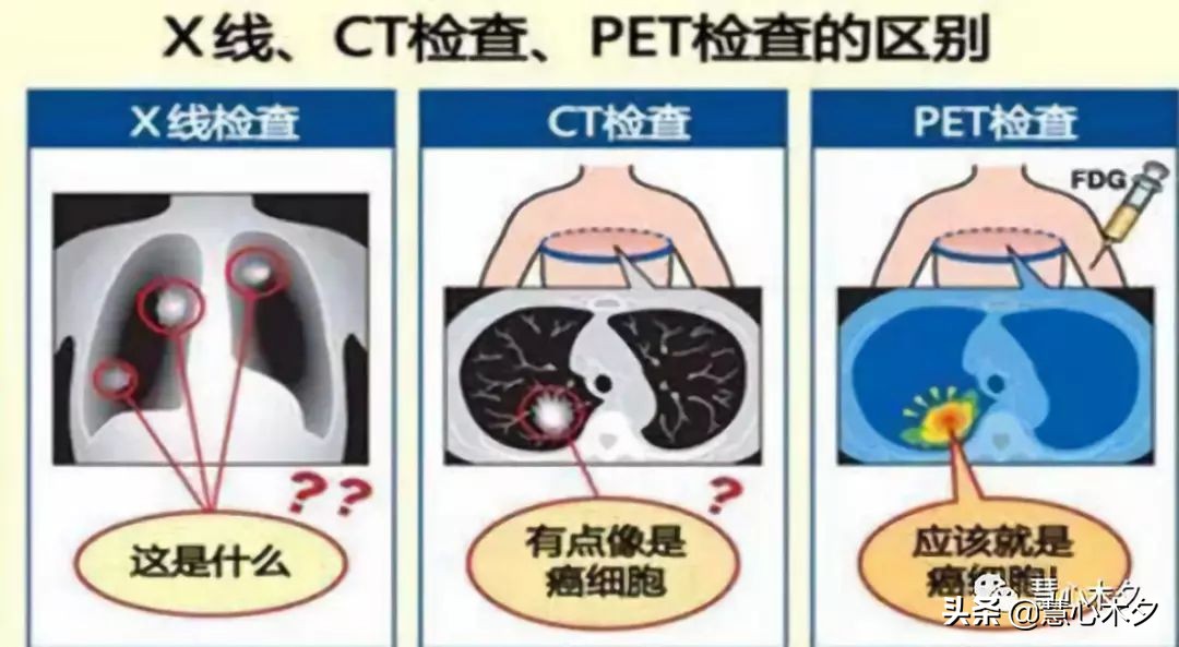 X片，CT，磁共振，影像学检查辐射知多少？