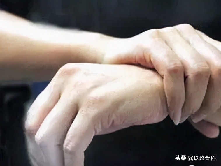 健康科普 | 手指关节痛是什么原因？