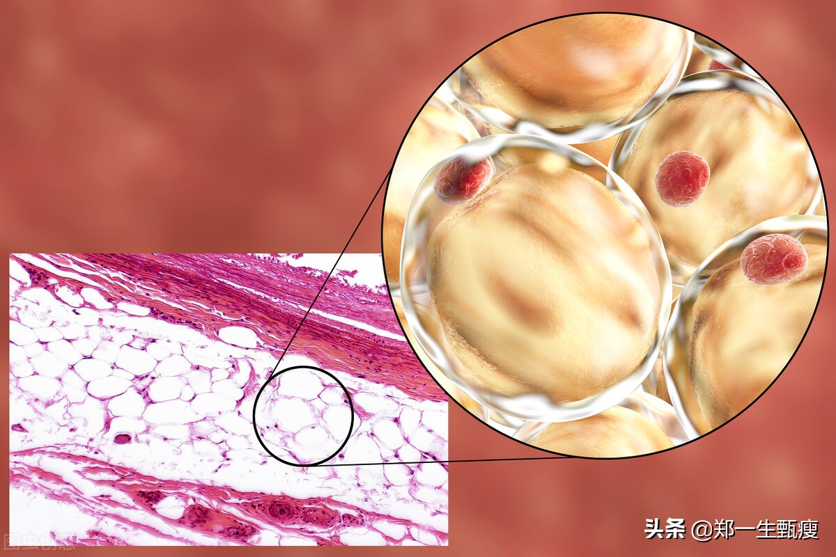 你瞭解什麼是皮下脂肪嗎?