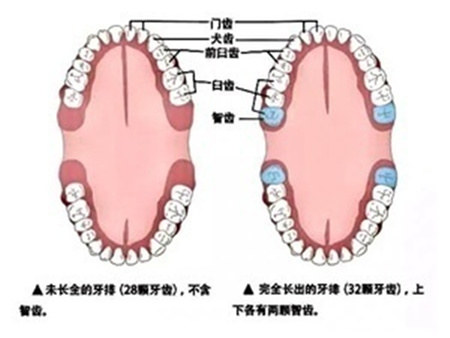 长了智齿，最好是拔掉？医生建议：一种情况可以留着