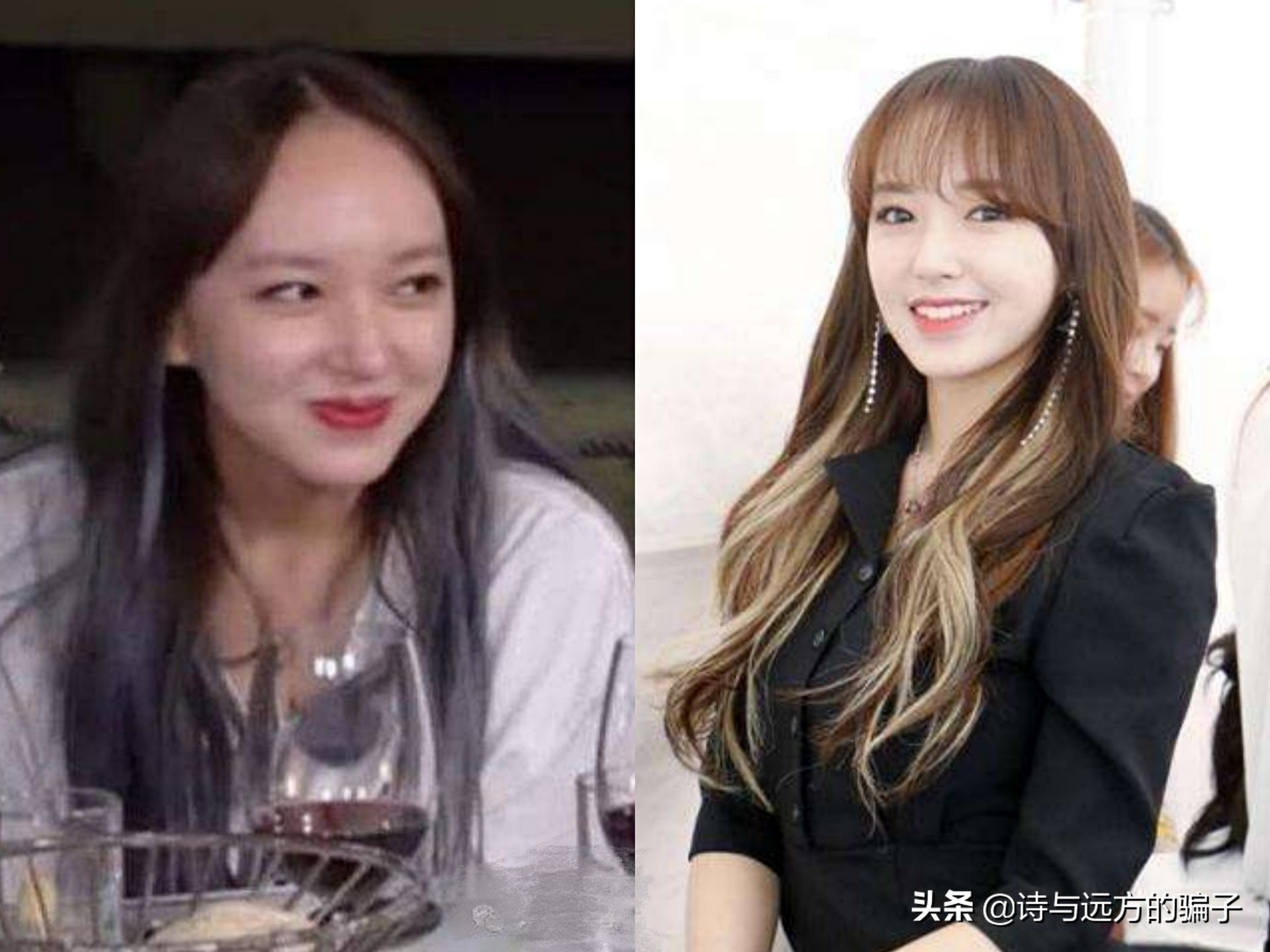 发际线自救，跟高额角，方脑门说拜，秃头女孩实现圆润饱满小脸梦