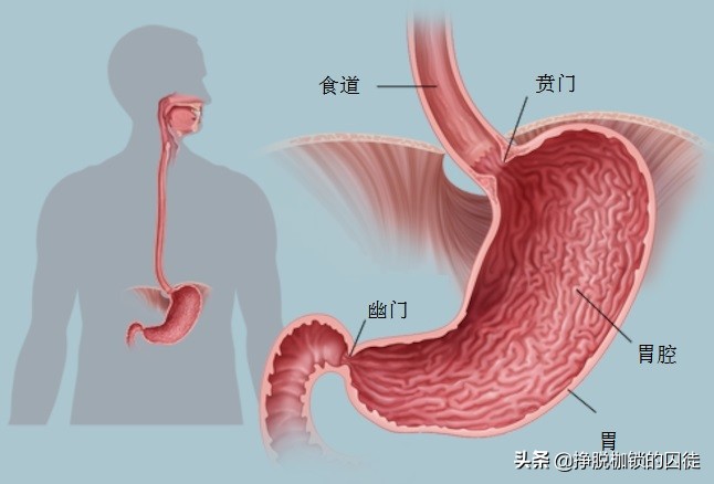 胃高胃突出是怎么回事图片