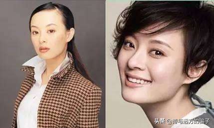 发际线自救，跟高额角，方脑门说拜，秃头女孩实现圆润饱满小脸梦