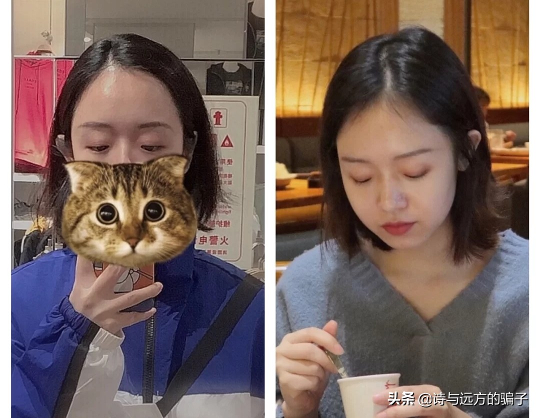 发际线自救，跟高额角，方脑门说拜，秃头女孩实现圆润饱满小脸梦