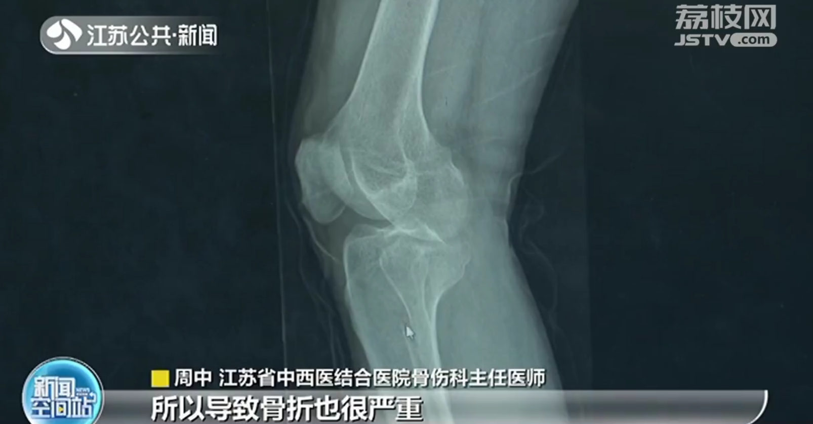 南京下雪市民纷纷摔倒求医 医生：试试“企鹅步”